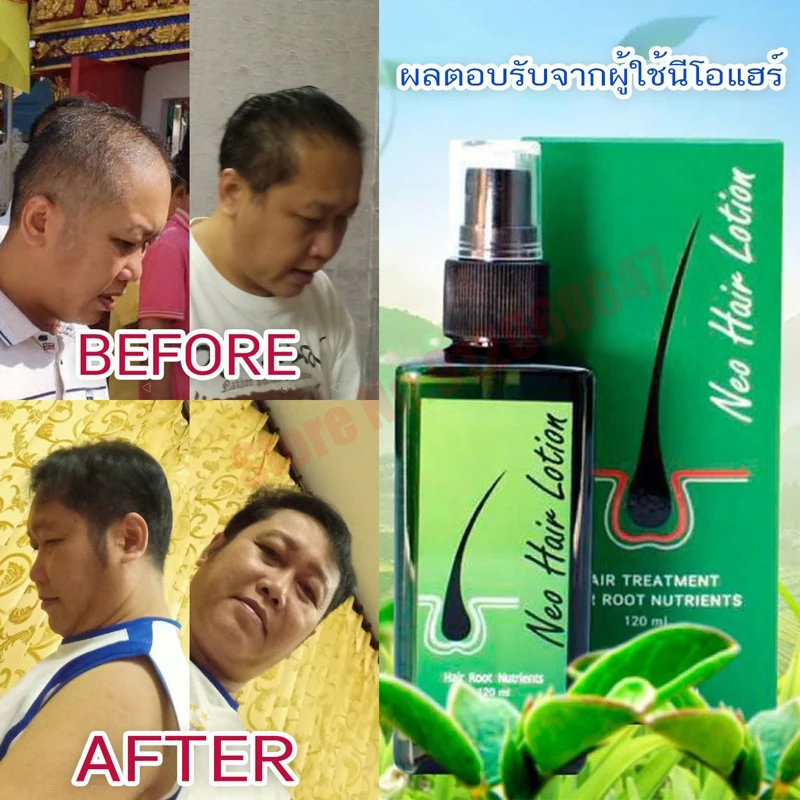 

Лосьон для волос Neo, травы, 100% натуральный лечебный спрей для предотвращения выпадения волос, корней, бороды, бакенбард, с более длинными пит...