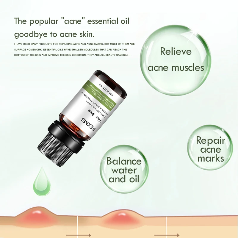 

100% Pure Tea Tree Essential Oil - High Quality Tea Tree Oil For Skin, Hair, Dry Scalp, Nails, Aromatherapy And Diffuser