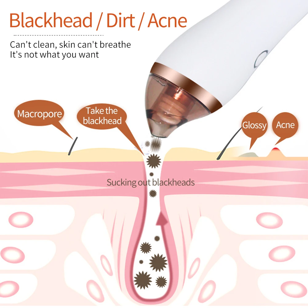 

Comedone Massage Nose Acne Extractor Vacuum Suction Home USB Rechargeable 4 Modes Cupping Cleaner Electric Blackhead Remover