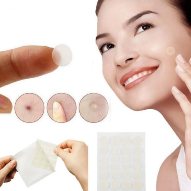 

36Pcs/Sheet Invisible Acne Patch Set Pimple Treatment Acne Removers Pimple Master Patch Treatment Acne Stickers Facial Care Tool