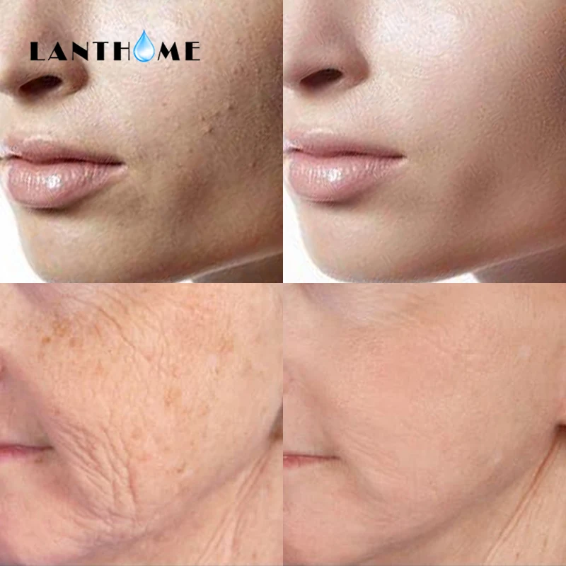 Ретинол витамин а 2.5% и сыворотка гиалуроновой кислоты антиоксидант против