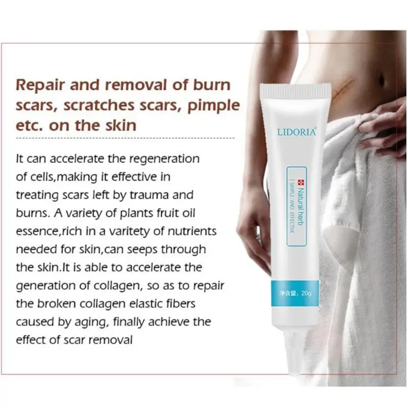 20 г натуральный травяной экстракт шрамовый Крем Для Удаления растяжек для