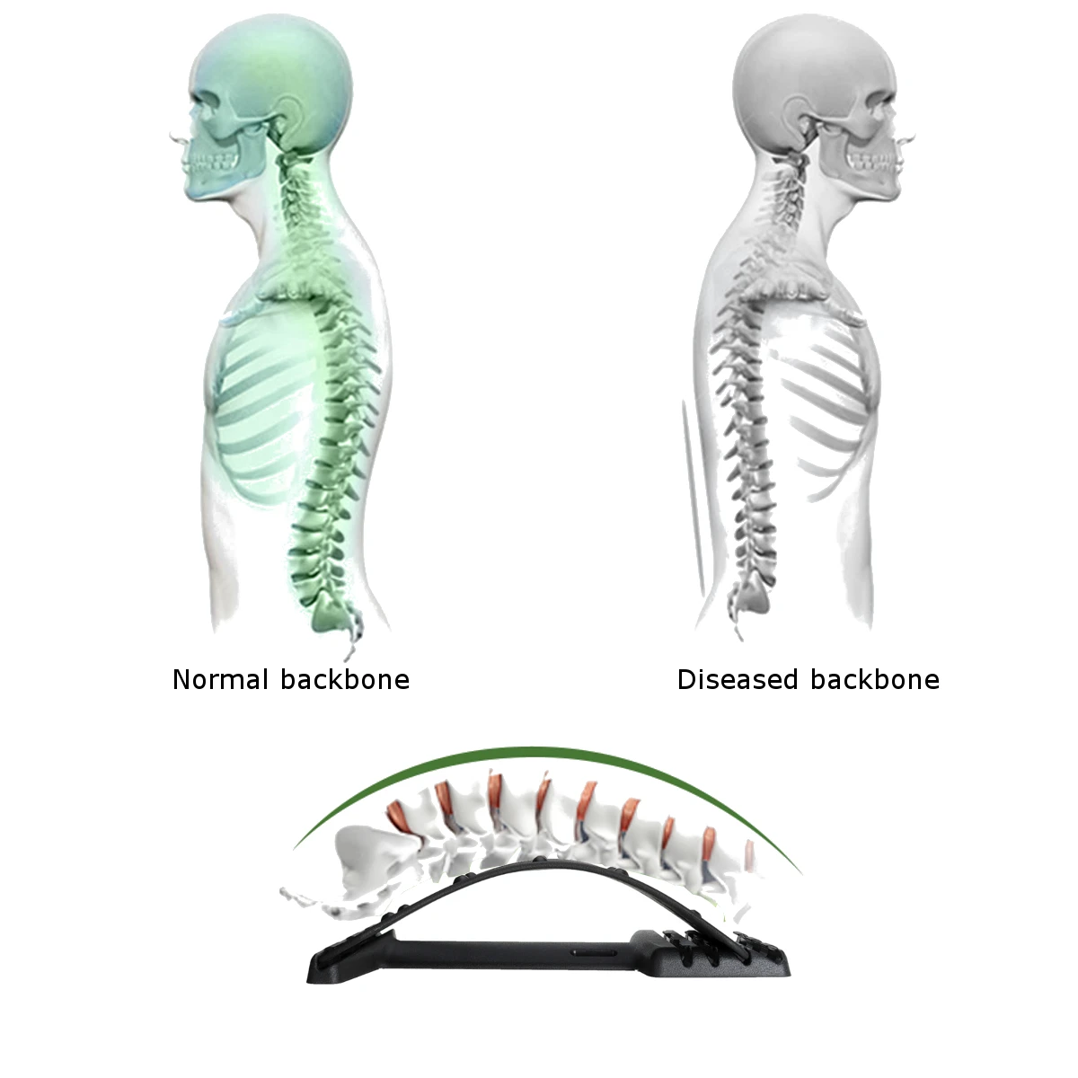 Magnetic Back Stretch Equipment Massager Stretcher Fitness Lumbar Support Relaxation Spine Pain Relief Corrector Health Care | Красота и