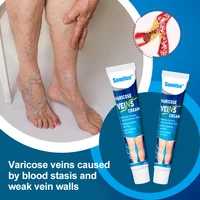 varicose veins treatment cream vasculitis phlebitis spider ointment varicosity angiitis effective removal herbal medical plaste