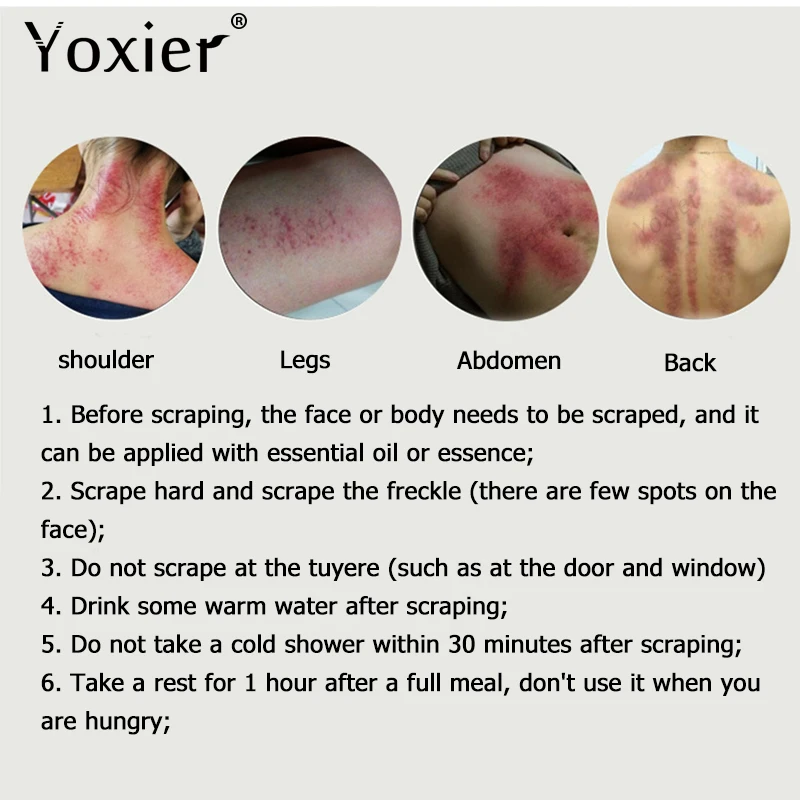 

Yoxier Triangle Guasha Scraping Health Care Massager Acupuncture Relaxation SPA Face-Lift Firming Improve Repair Body Care 1Pcs