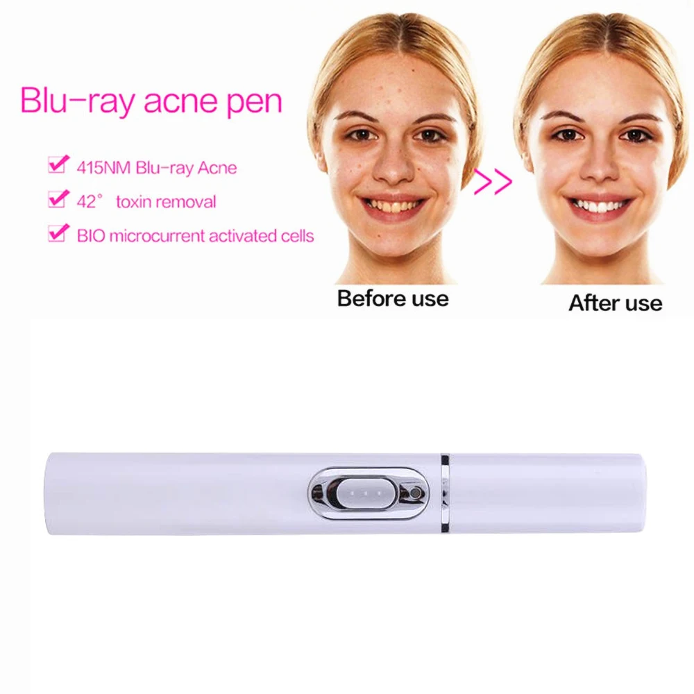 Акне лазерная ручка Портативный удаление морщин машина прочный мягкий крем для