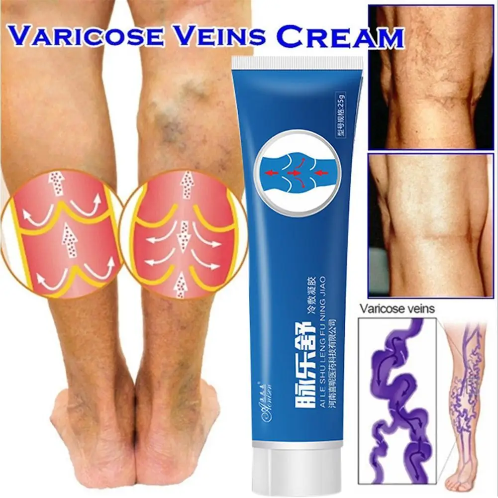 Крем от варикозного расширения вен эффективное лечение Варикозного васкулит