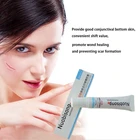 5x Nuobisong крем для удаления шрамов от акне, гель для шрамов, крем для восстановления кожи лица, лечение акне, уход за кожей, отбеливающие растяжки