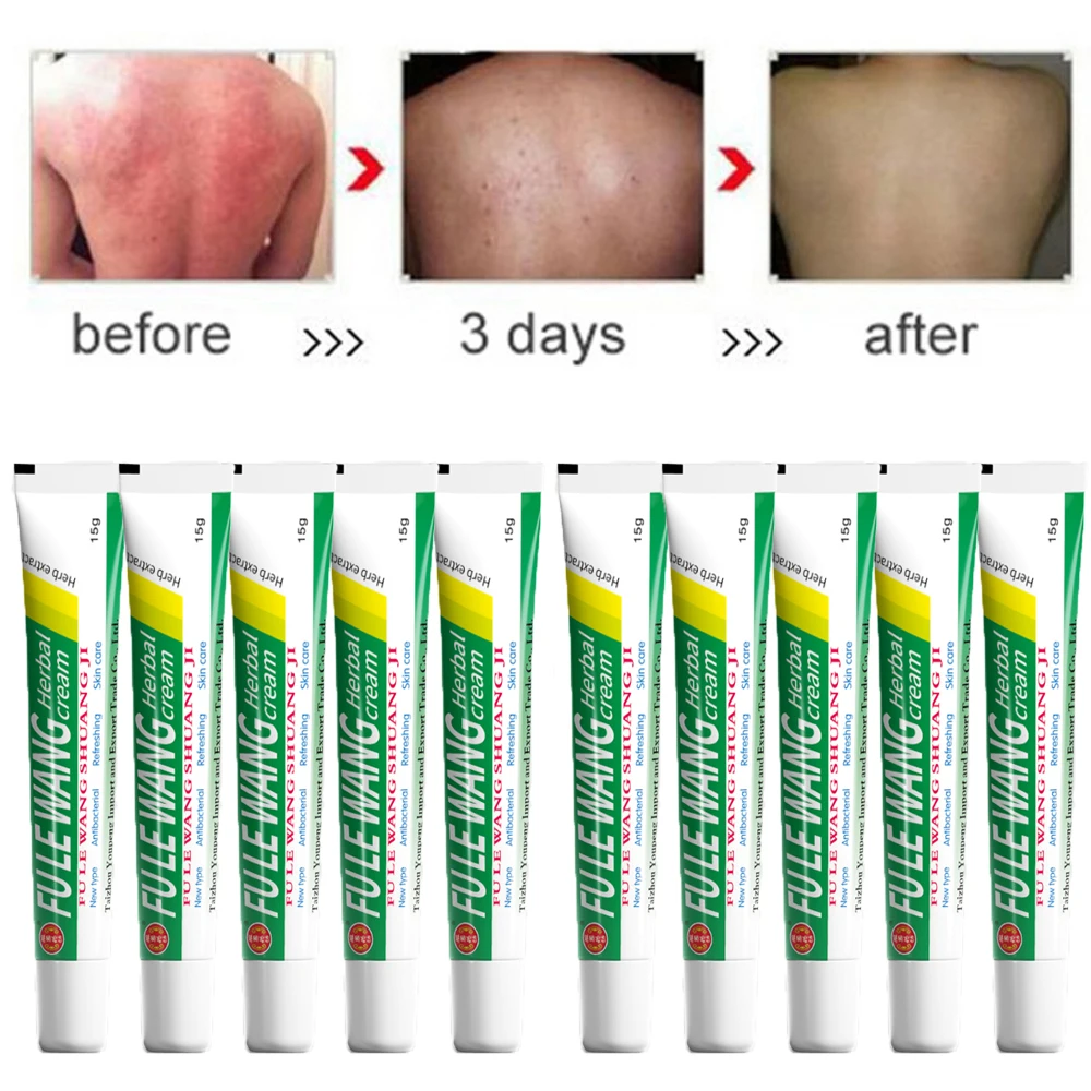 

20Pcs Original FULEWANG Skin Psoriasis Cream Dermatitis Eczematoid Eczema Ointment Treatment 15G With Box Wholesale Zudaifu