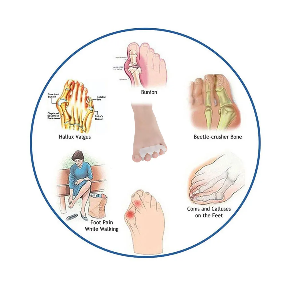 

Tcare 1Pair Fashion Foot Care Three Toes Bunion Corrector Hallux Valgus Corrector Splint Three Toes Straighteners Pain Relief