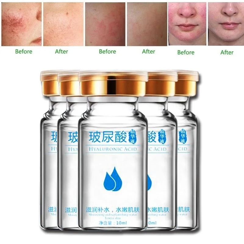 Шелковое эфирное масло с гиалуроновой кислотой для удаления покраснений на лице