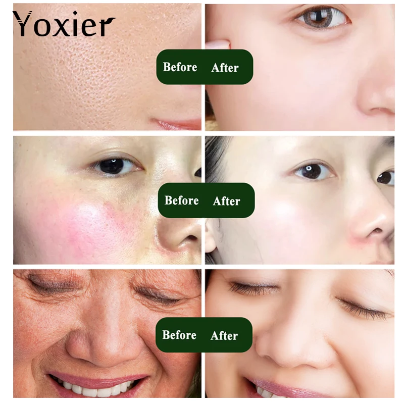 Yoxier лицо улитки сыворотка шесть пептидов против старения морщин укрепляющий