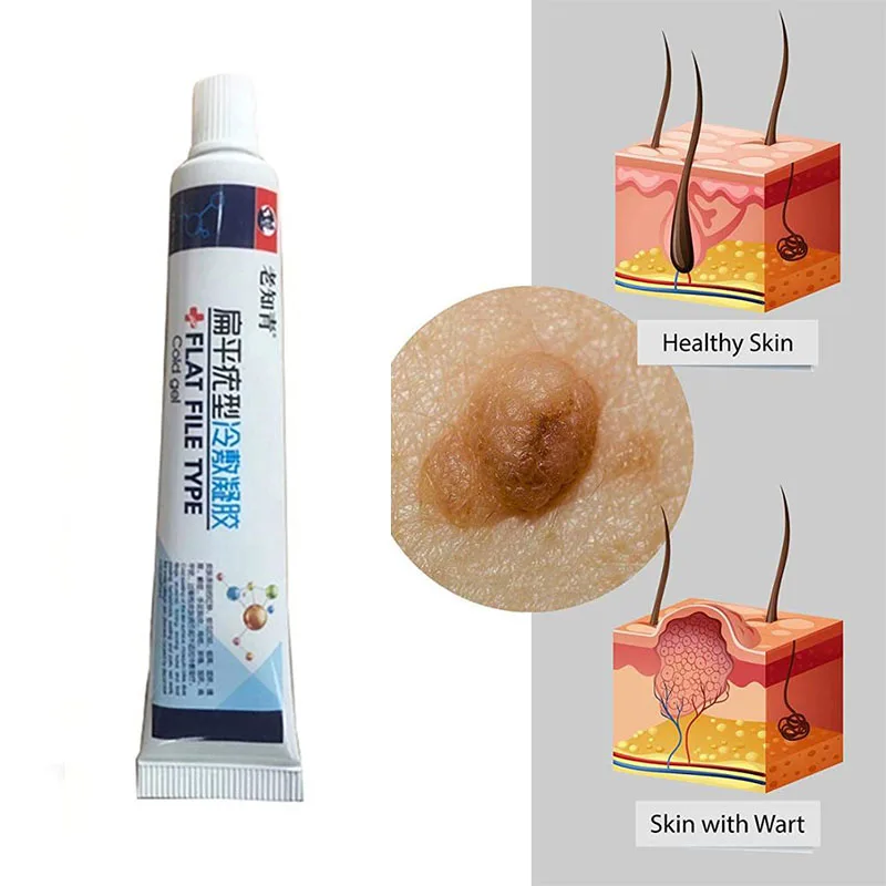 Удаление бородавок на коже удаление жидкости с кожи моли|Устройство для ухода за