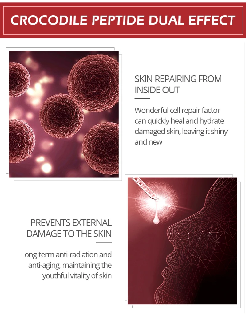 30 мл ярких шик Гиалуроновая кислота уход за кожей лица Отбеливание сокращает