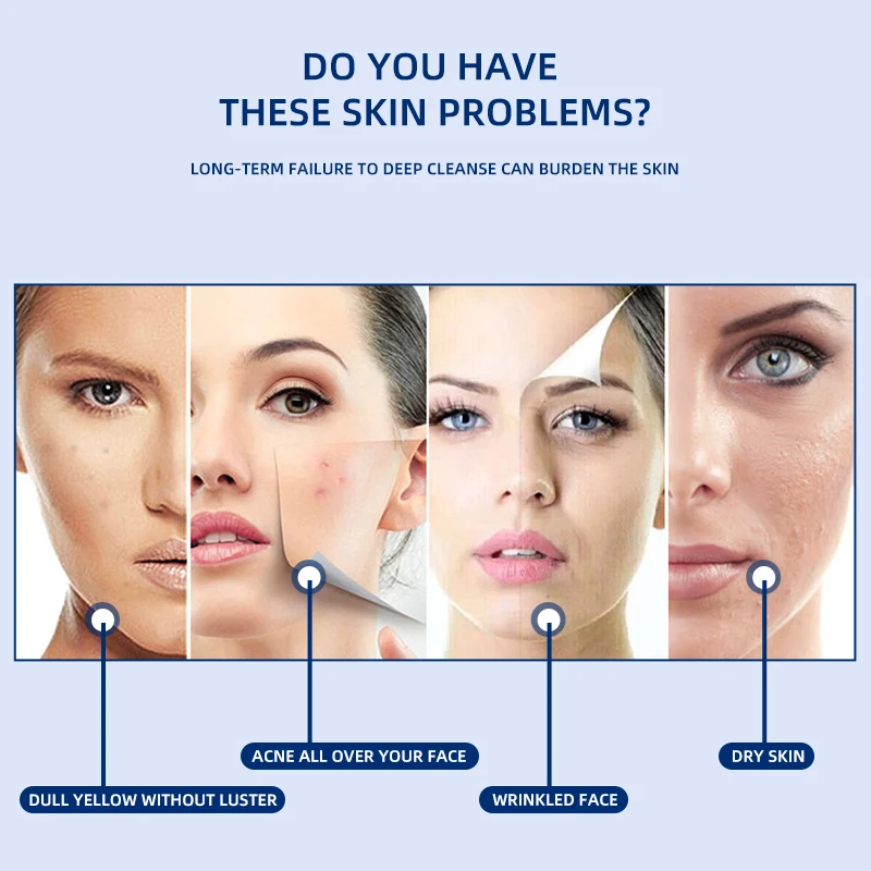 Goede K · Huid Verstevigende Facial Massager Ultrasound Anti Veroudering En Rimpels Huidverstrakking Apparatuur Ipl Led Gezichtsverzorging Beauty Slim Apparaat