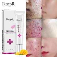 anti acne cream spots scar treatment cream shrink pores moisturizing skin care sana889