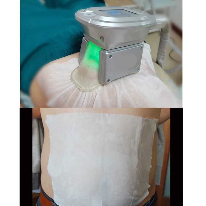 20 шт. антифриз мембрана для устройства замораживания жира похудения Lipo