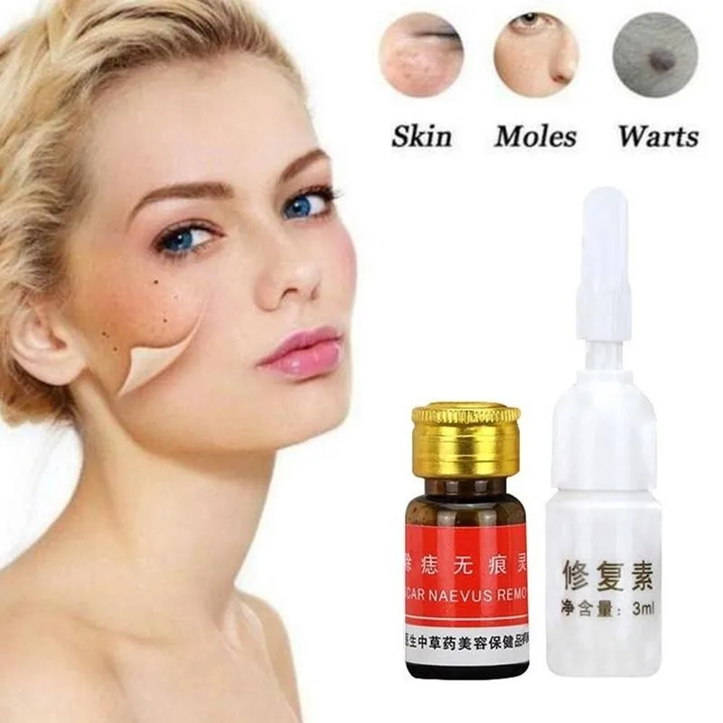 

No Trace Mole Cream Freckle Removal Cream Face Care Removal Solution Treatment Professional Acne Painless Mole Repair Cream
