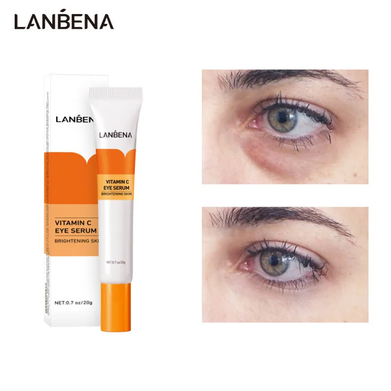 

LANBENA Vitamin C Whitening Eye Serum Nicotinamide Brighten Remove Dark Circles Anti Puffiness Reduce Pigmentation Eye Cream