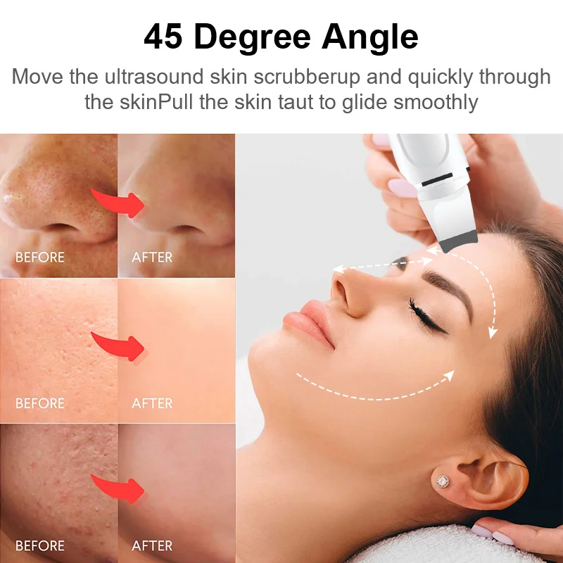 Skin cleaner facial care ultrasonic skin vibrating spatula black spot |