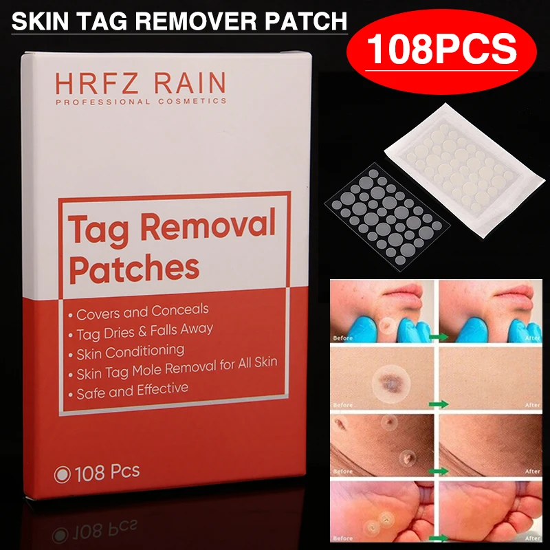 

108pcs/pack Skin Tag Remover Patch Dispel Warts Stickers Painless Warts Treatment Patches Anti Infection Acne Pimple Removal