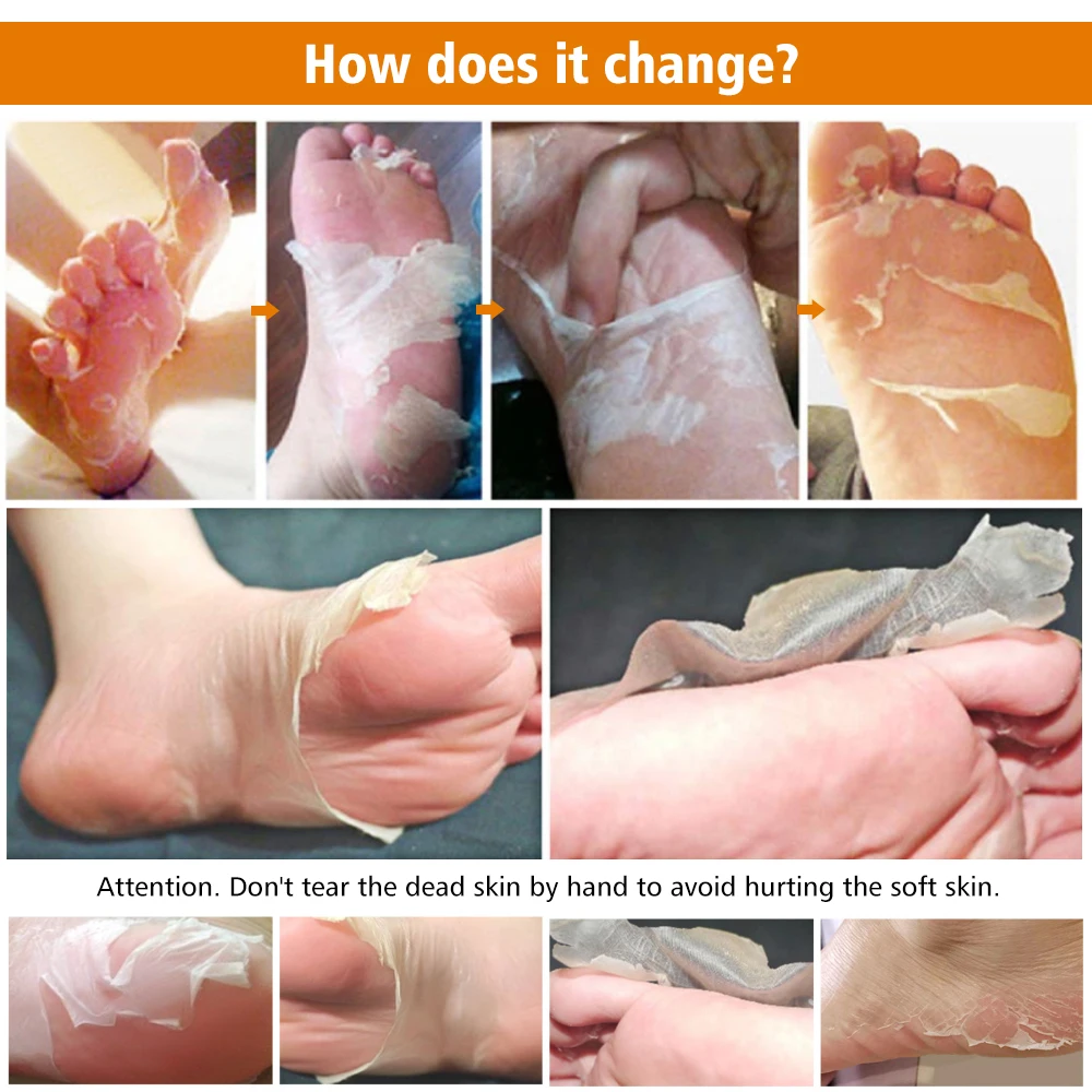 1 пара/мешок отшелушивающая маска для ног носки пилинг удаления омертвевшей кожи