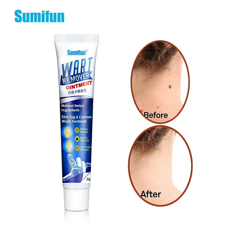 

Sumifun Warts Remover Antibacterial Ointment Wart Treatment Cream Skin Tag Remover Herbal Extract Corn Plaster Warts Ointment