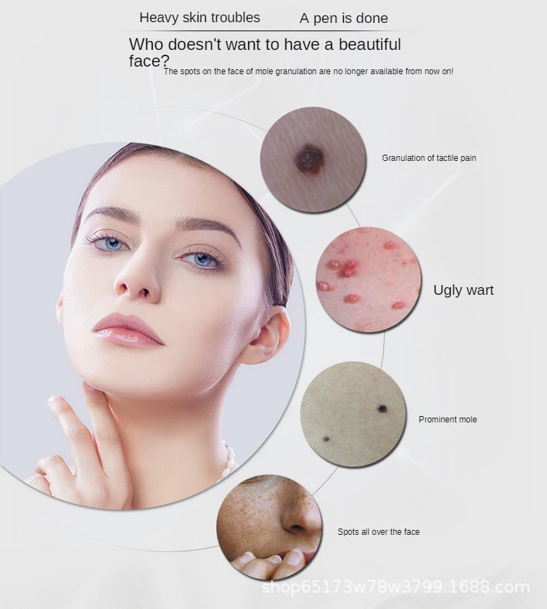 Ручка для удаления родинок бытовая ручка пятен с сисветильник Том маленькая