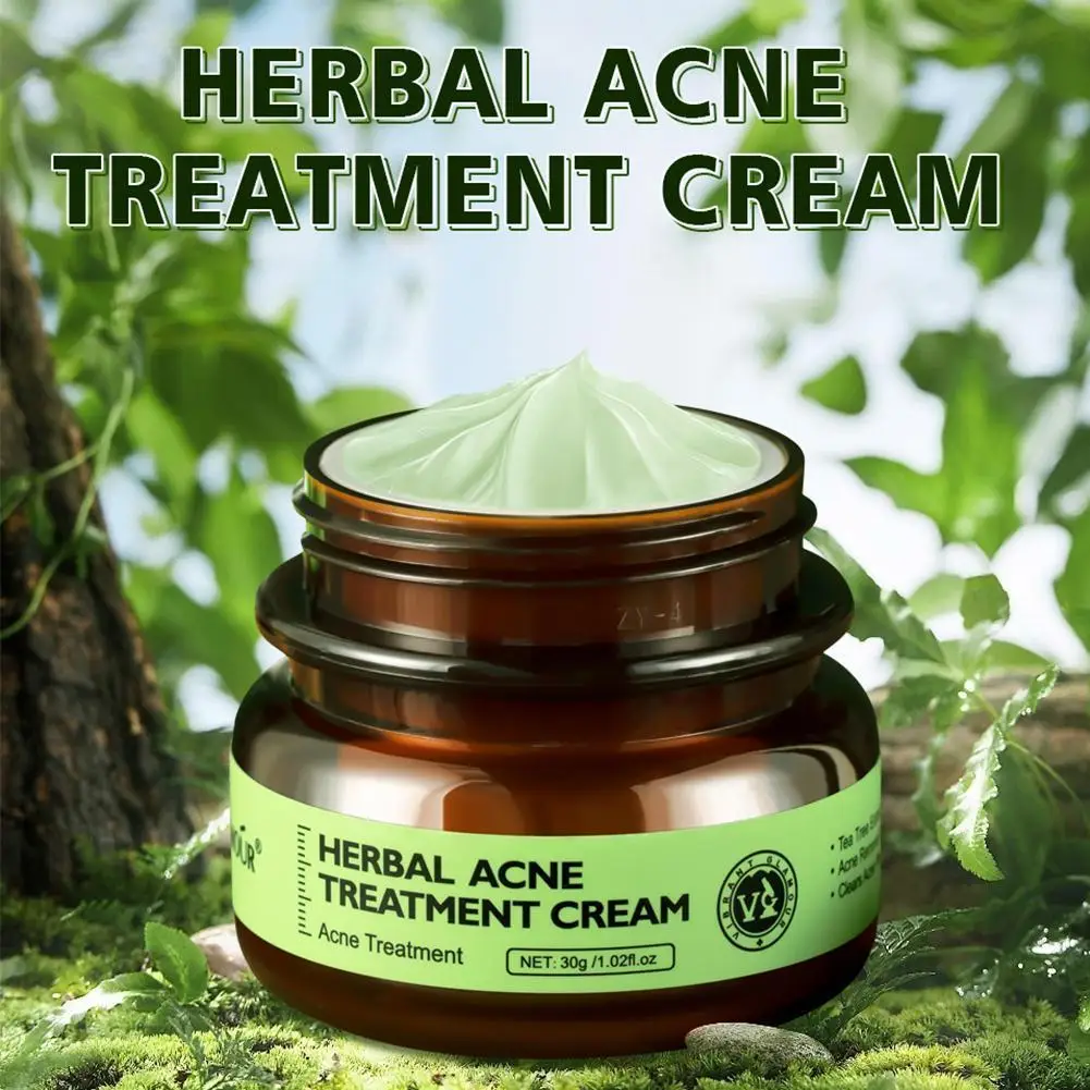 

30g Herbal Acne Treatment Cream Oil Control Anti-acne Brighten Nourish Whitening Shrink Pores Remove Scars Marks Skin Cream
