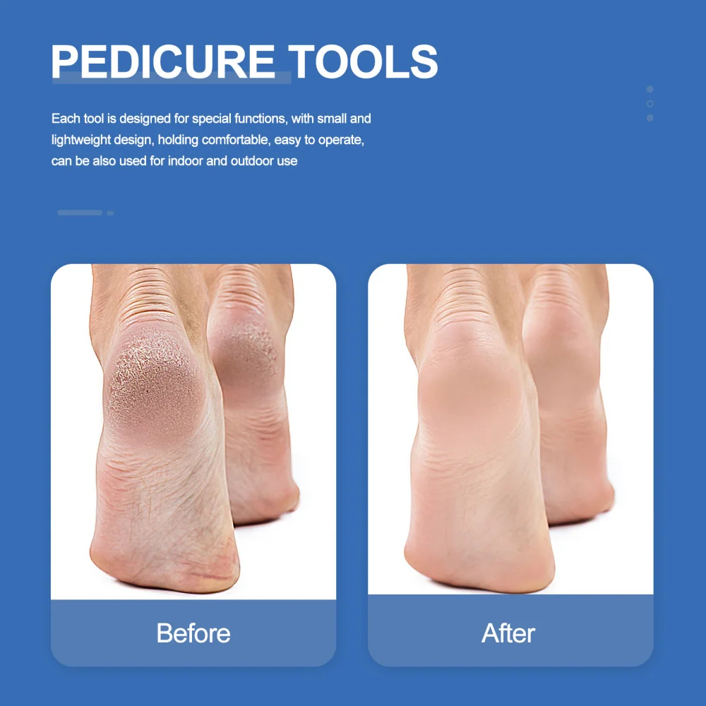 

6pcs Pedicure Kit with Storage Bag Foot File Callus Remover Rasp for Dead Skin