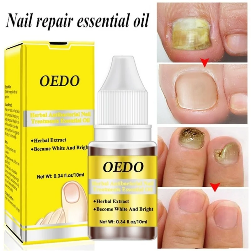 1 шт. бактерицидная натуральные эфирные масла для ногтей жидкость ремонт лечения