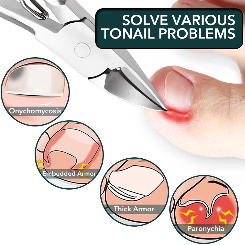 1Pc Toenail Nail Clippers Cutters Stainless Steel Pedicure Manicure Tools Professional Thick Ingrown Paronychia  Correction Tool