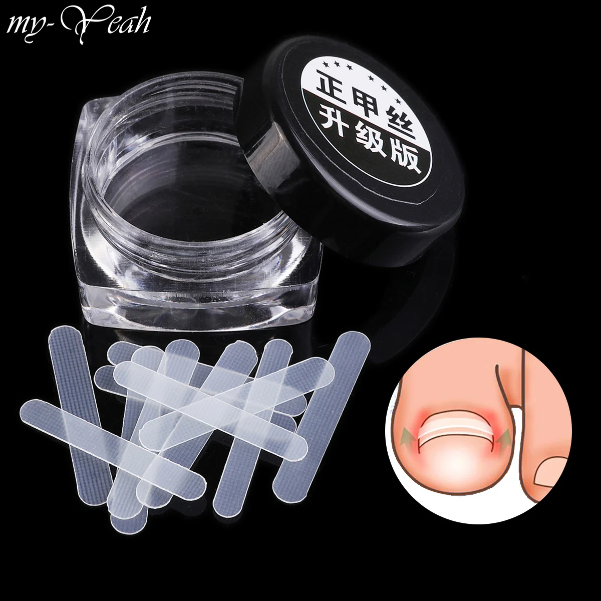 12 шт./кор. проволочный фиксатор для коррекции ногтей из нержавеющей стали пароникья корректор ухода за