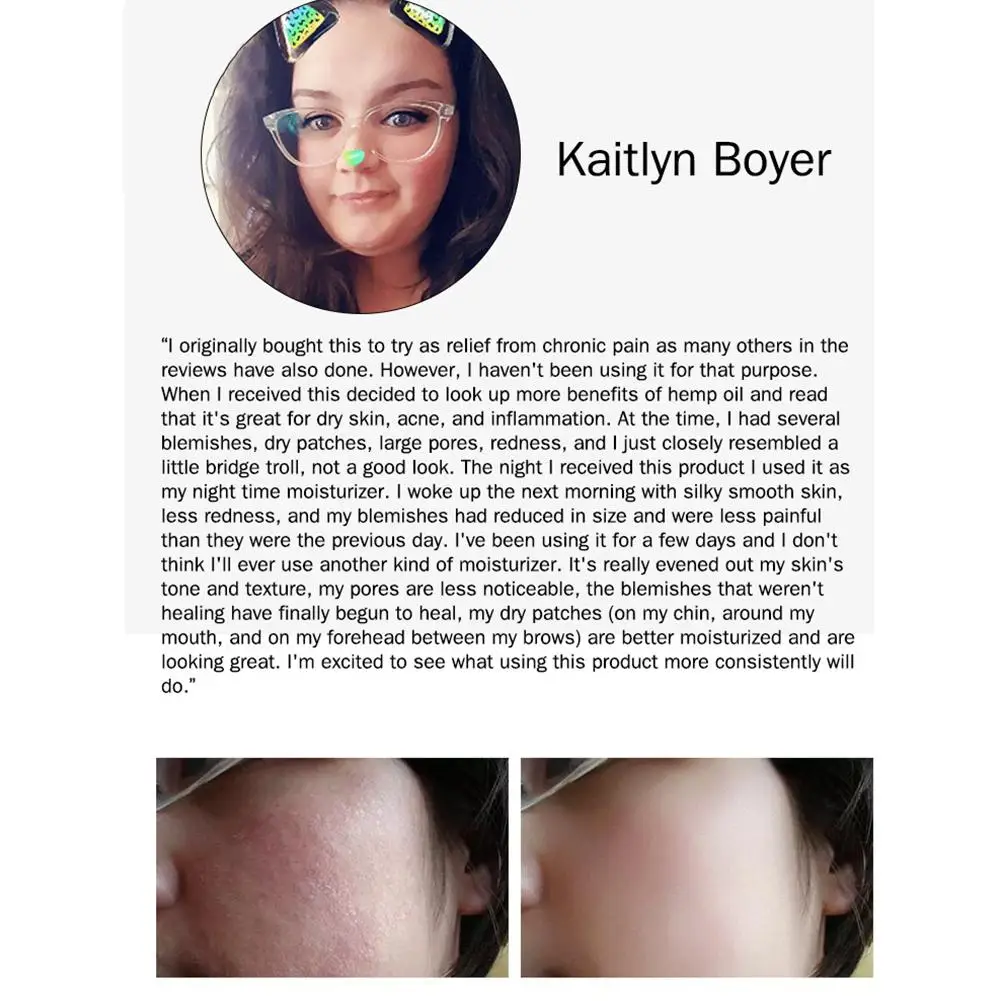 Яркое Гламурное органическое из конопляных семян масла массаж для снятия боли