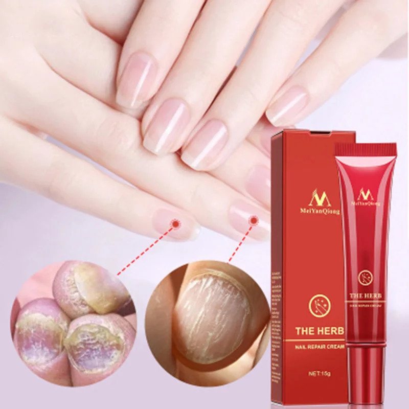 Восстанавливающий Крем для ногтей с натуральными травами крем против