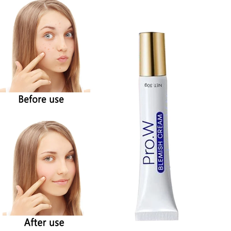 

Pro.W Acne Treatment Blackhead Removal Cream Anti Acne Cream Water-oil Balance Shrink Pores Blemish Cream Face Care 30g