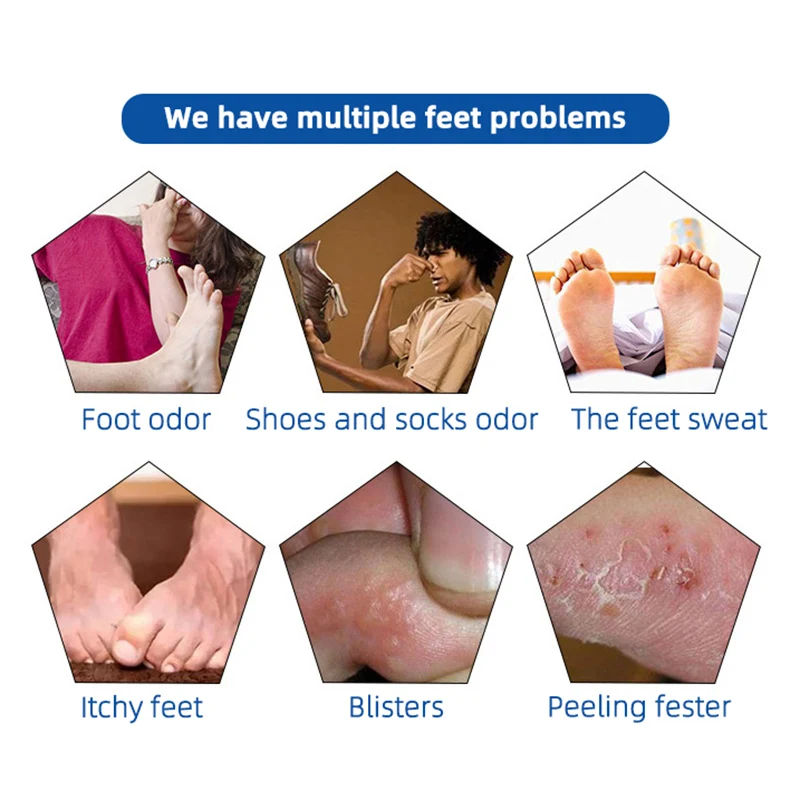 1PC Remove Foot Odor Sweat Antibacterial Bacteriostatic Plant Herb Spray Sterilization 60ML | Красота и здоровье