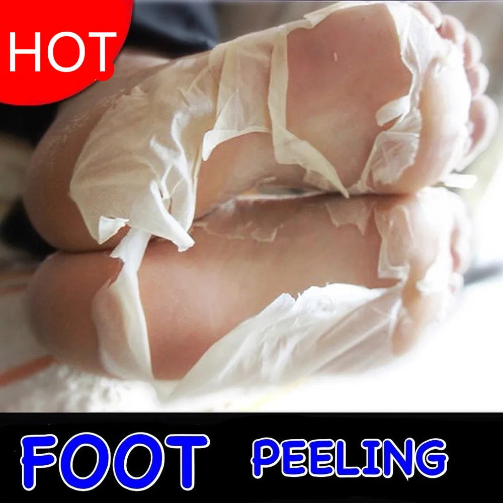Новейшая модель омертвевшие чешуйки кожи и снятия с рисунками бабочки пилинг