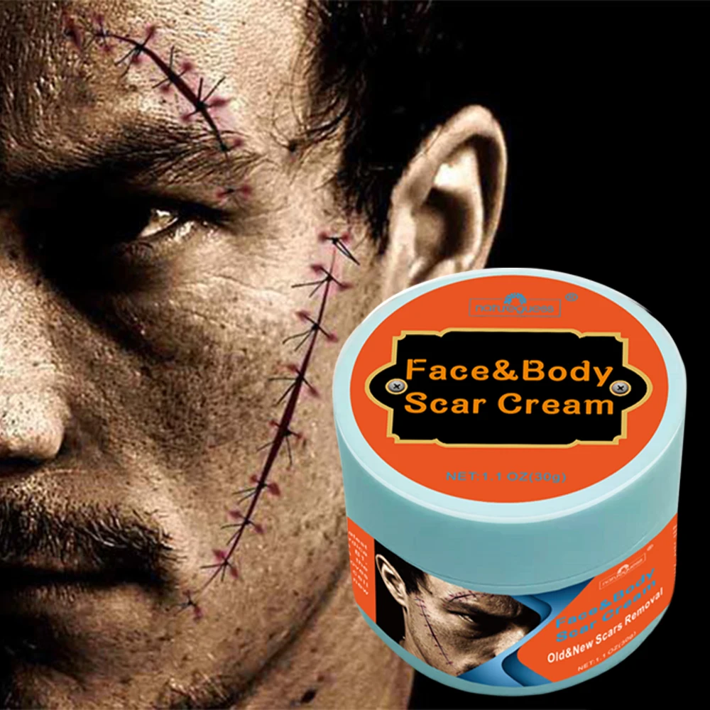 Effective Acne Scar Removal Face Cream Pimples Stretch Marks Gel Remove Smoothing Whitening Moisturizing Body Skin Care | Красота и
