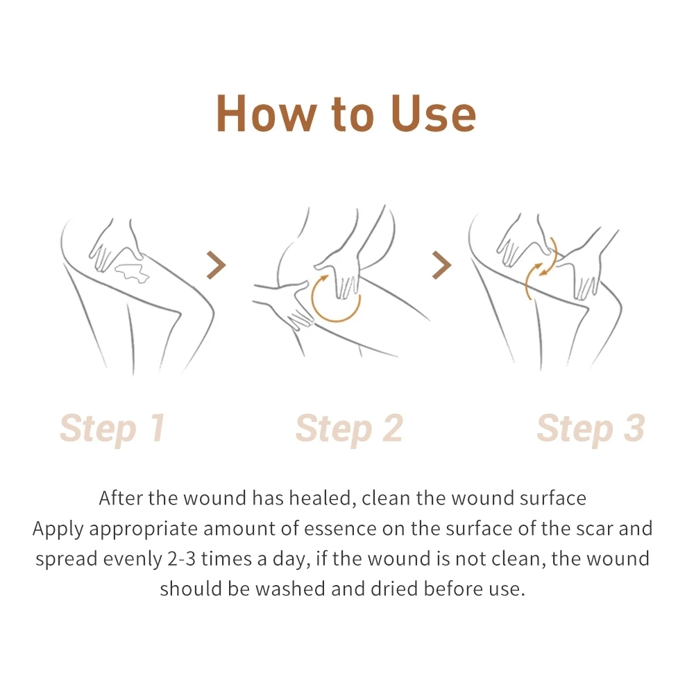 Крем LANBENA для удаления шрамов от акне отбеливающий крем ухода за кожей лица