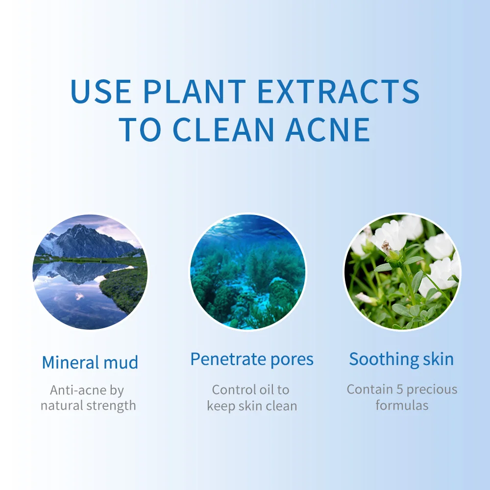 Маска для лица WIS из зеленой глины минералы контроль жирности лечение акне