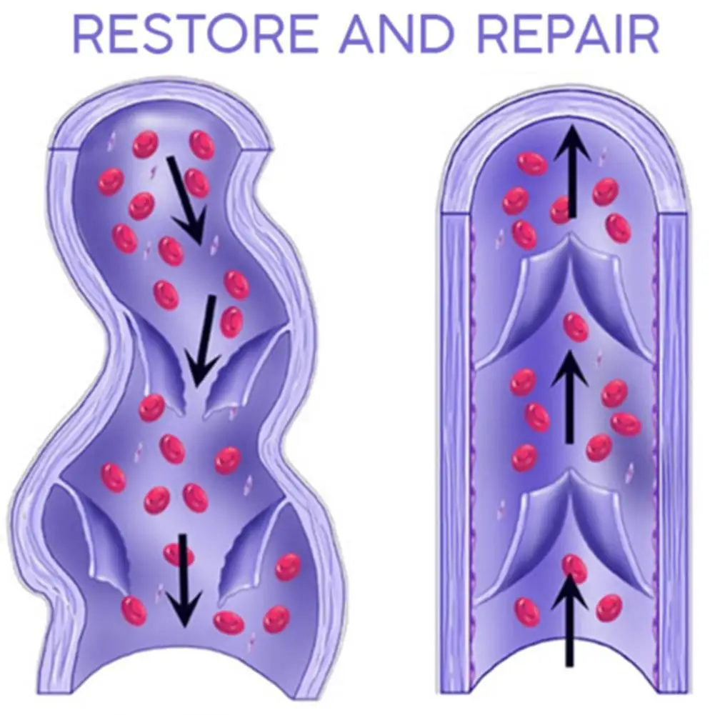 Наклейки на сосуды для облегчения боли в позвоночнике и пояснице|Инструмент