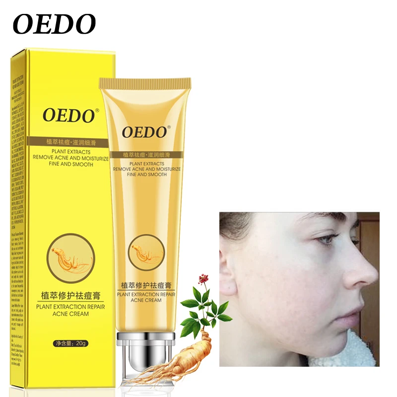 

Plant Extraction Repair Acne Cream Ginseng Scutellariae Extract Face Care Acne Treatment Skin Care Facial Cream Whitening 20g