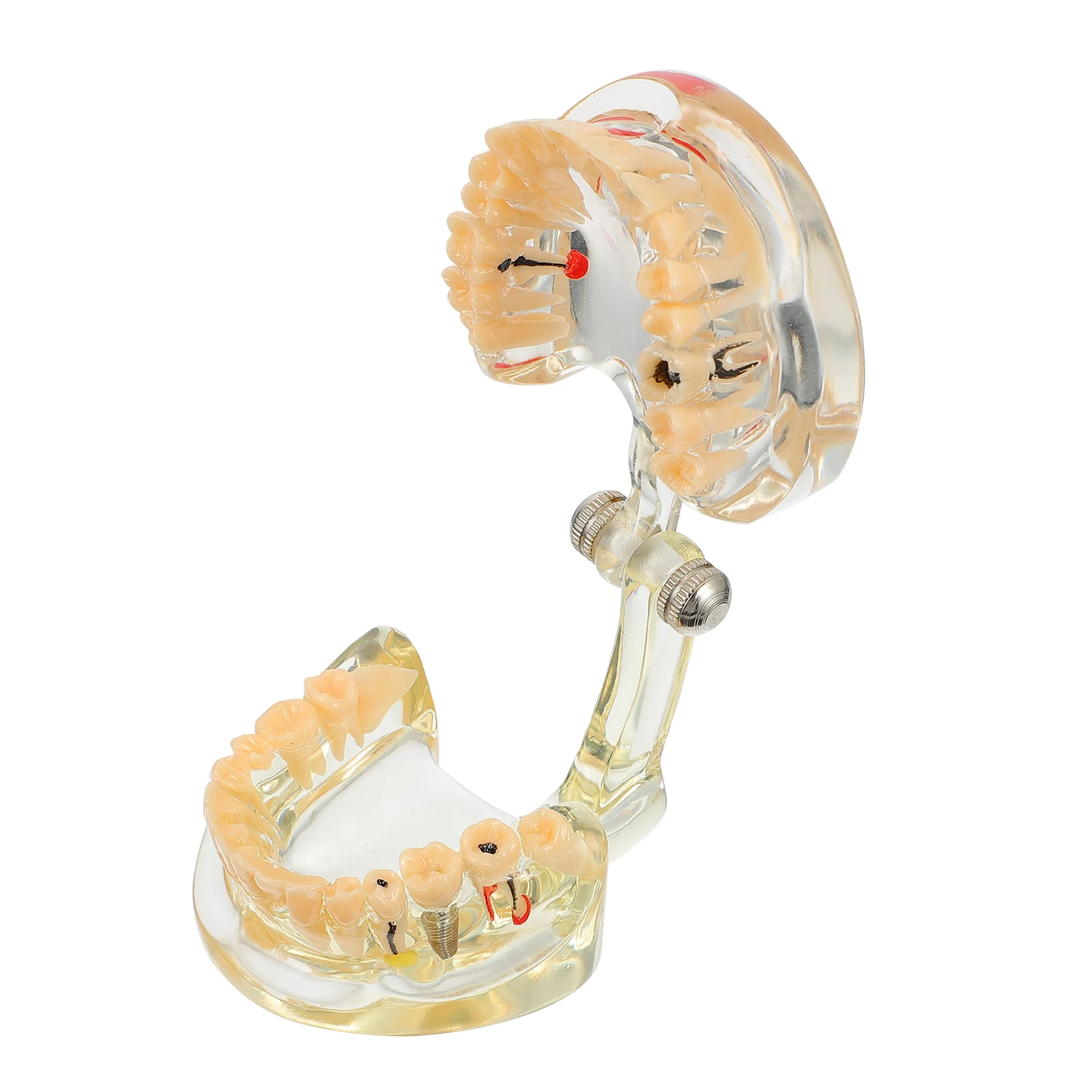 

1 шт., модель зубного импланта, съемная модель для восстановления зубов (прозрачная)