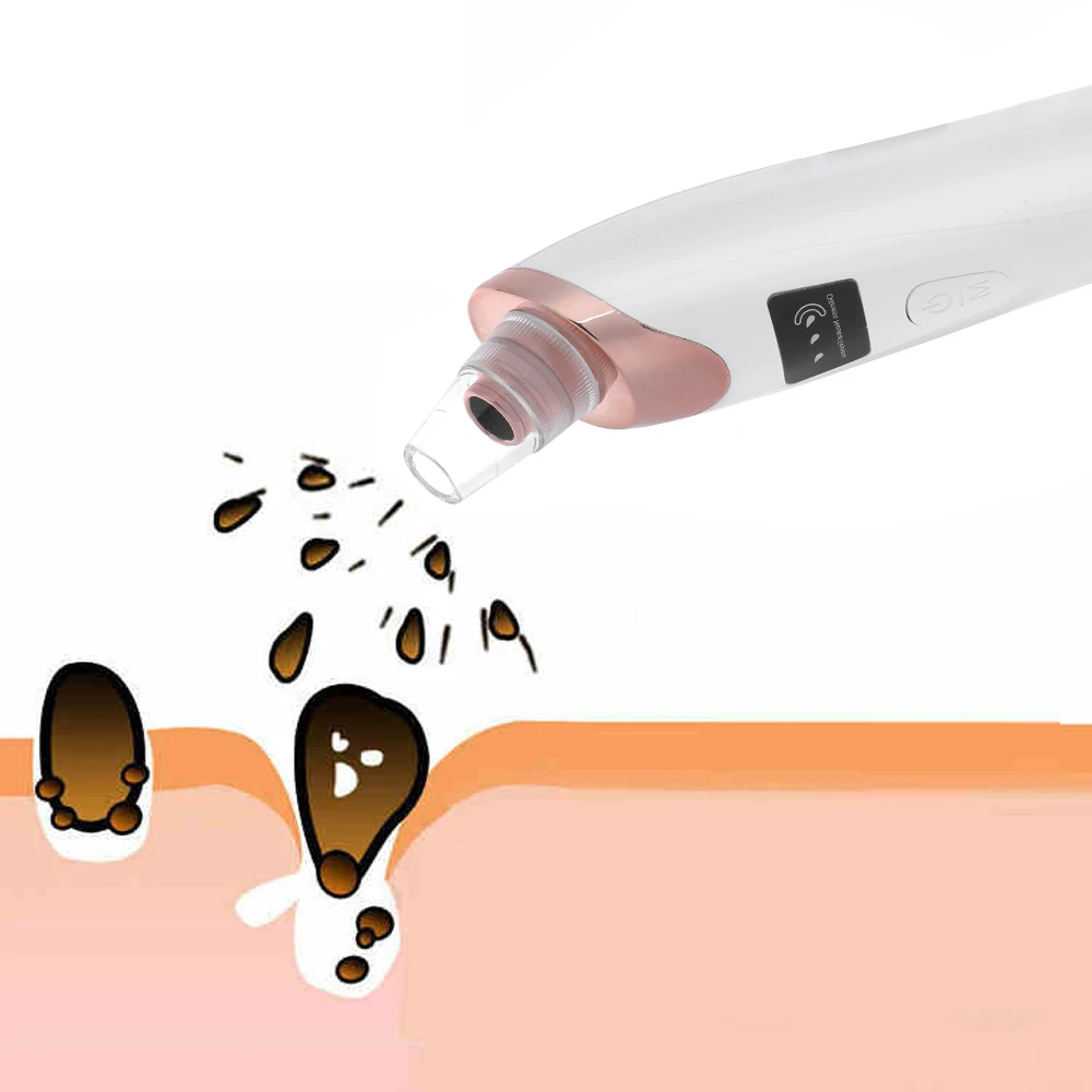 Вакуумное средство для удаления черных точек на носа и лица акне прыщей ухода за