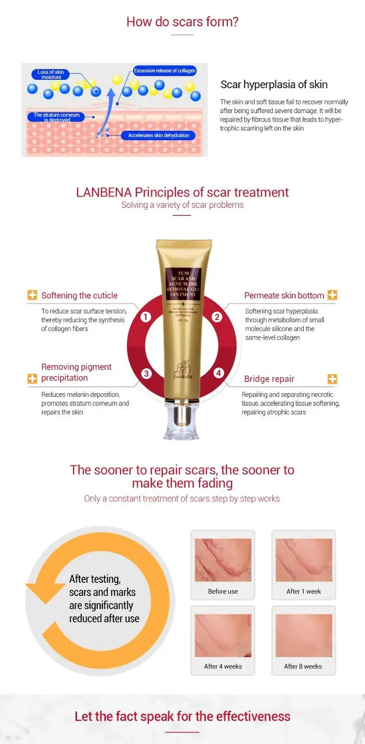 Новинка 2019 крем для ухода за кожей от растяжек уход тела|Косметические наборы| |