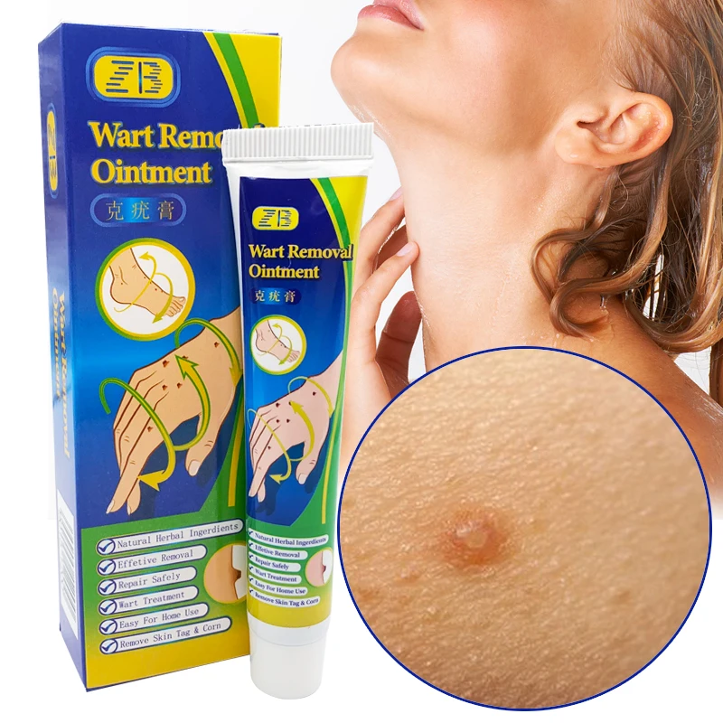 

Бриллиантовый крем для лица и тела, 20 г, травяные этикетки для удаления кожи, мазь, кукуруза для ног, антибактериальный пластырь для красоты кожи