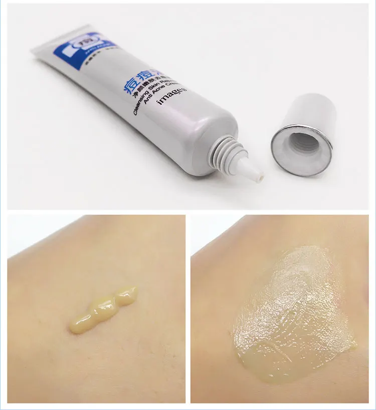 

OEM ODM bulk beauty products moisturizing skin acne cream for face care