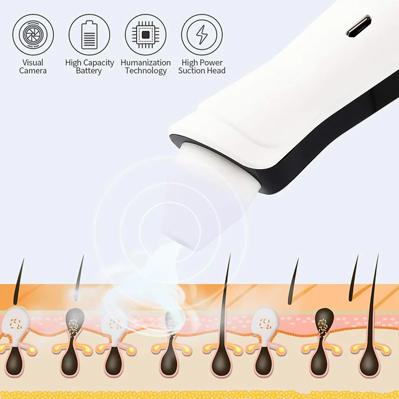 Визуальный Инструмент для удаления чёрных точек USB Перезаряжаемые поры лица