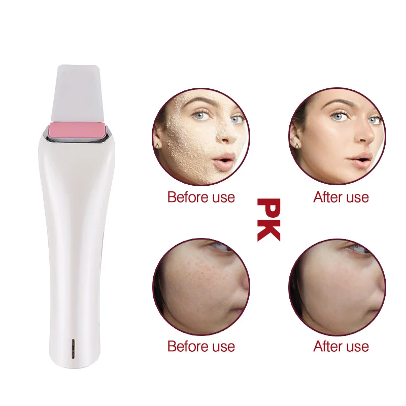 Ультразвуковая машина для очистки кожи лица с вибрацией и Скруббером удаления